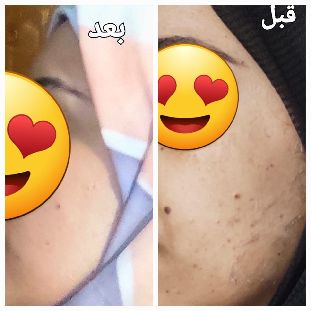 Brightening Box | بوكس التفتيح