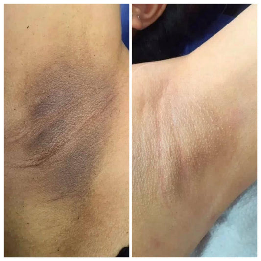 عرض بوكس جلامستا - كل اللي بشرتك محتاجاه في بوكس واحد