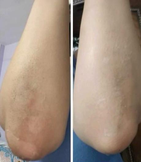 Glamista Peeling 60%