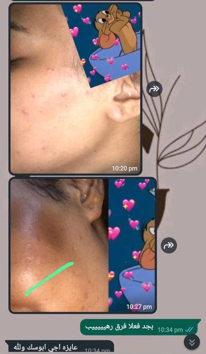 Glamista Peeling 20%