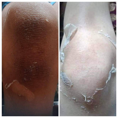 Glamista Peeling 60%